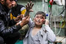 &lt;p&gt;Ranjeno dijete u Gazi&lt;/p&gt;