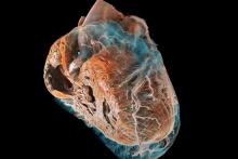 &lt;p&gt;3D tehnika snimanja srca&lt;/p&gt;