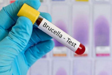 &lt;p&gt;Bruceloza u Vogošću&lt;/p&gt;